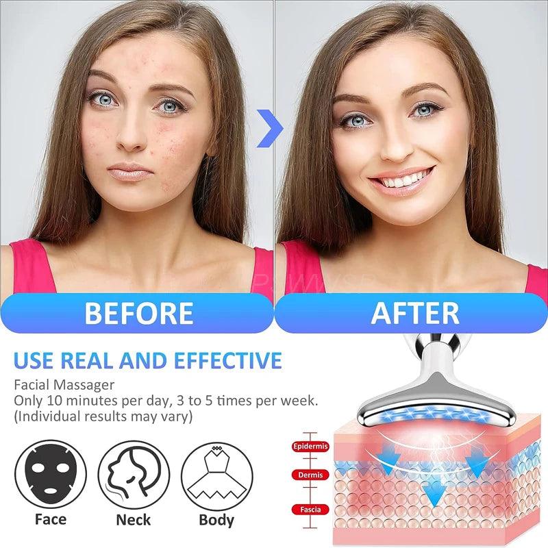 GlowLift Pro™ - Face Sculpting Tool - Zorelie