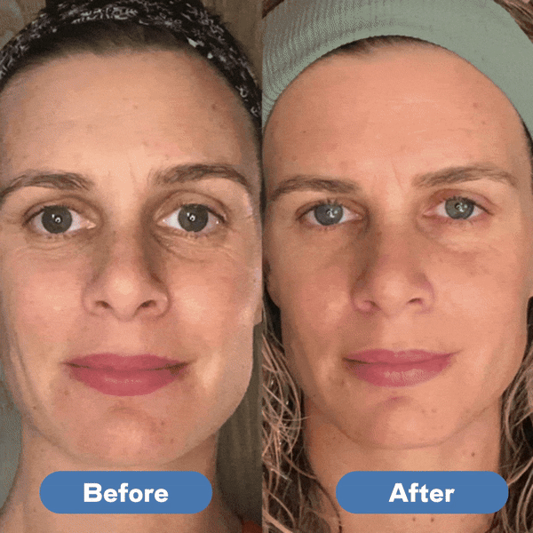 GlowLift Pro™ - Face Sculpting Tool - Zorelie