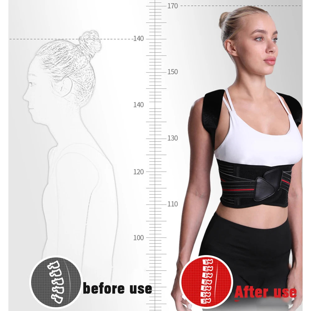 BraceTop™ Adjustable Posture Corrector – Back & Shoulder Alignment Support