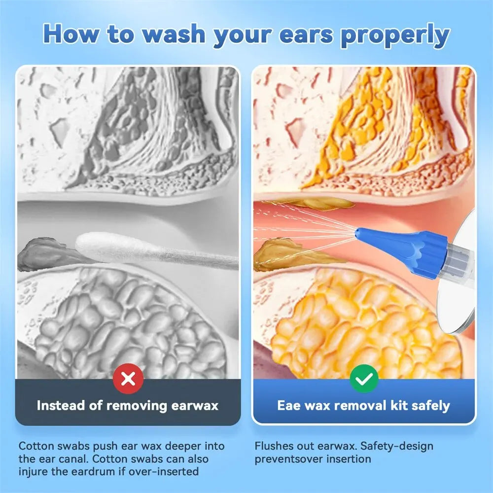 Ear Wax Removal Kit – Manual Ear Cleaner Water Irrigation Flushing System for Safe and Effective Ear Cleaning
