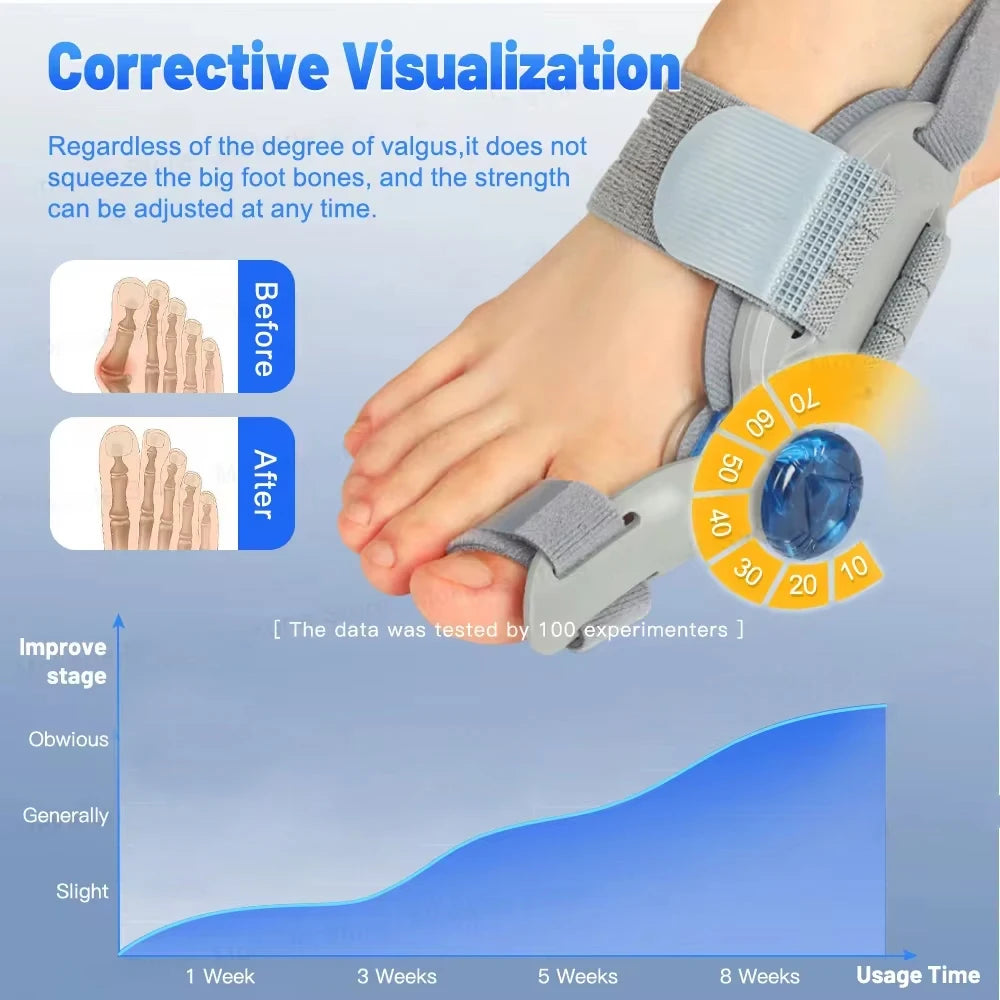 Adjustable Bunion Corrector – Hallux Valgus Toe Straightener & Orthopedic Foot Alignment Splint