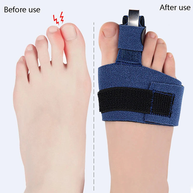 Toe Corrector & Bunion Straightener – Soft Orthotic Socks for Toe Alignment, Fracture Support & Foot Pain Relief