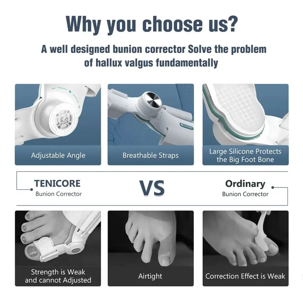 Bunion Corrector – Adjustable Hallux Valgus Orthotics Big Toe Straightener with 3-Angle Fixing Plate