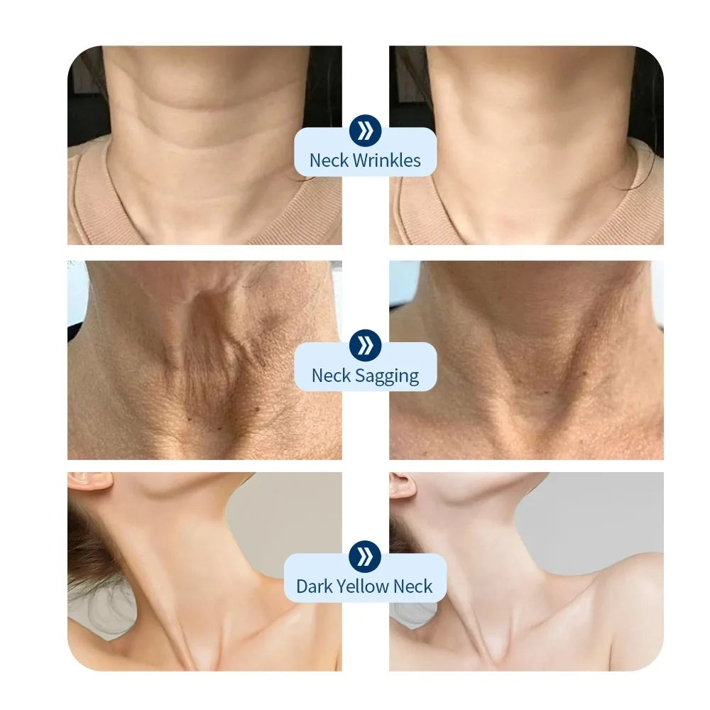 LED Neck Mask – Photon Therapy Skin Tightening Device, Anti-Wrinkle Neck Beauty Tool for Skin Brightening & Rejuvenation
