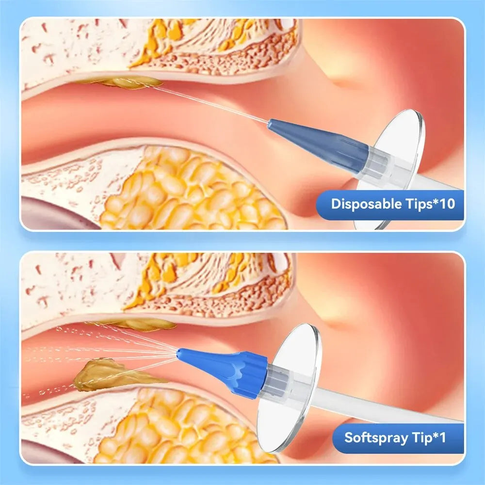 Ear Wax Removal Kit – Manual Ear Cleaner Water Irrigation Flushing System for Safe and Effective Ear Cleaning