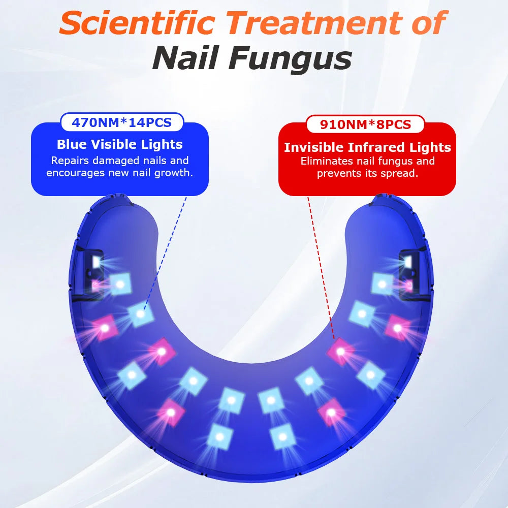 Wireless Nail Fungus Laser Treatment Device
