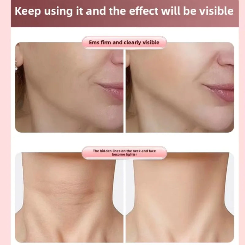 VioraLift™ EMS Face Roller – V-Line Beauty Massager