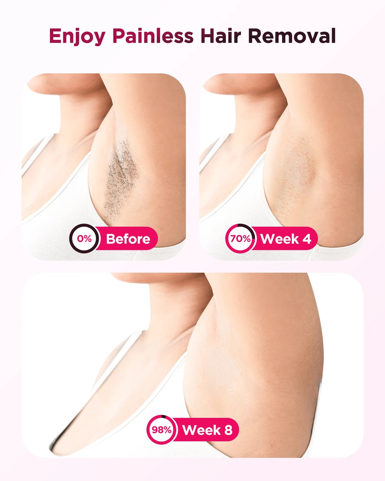 990K-Flash IPL Laser Epilator – Painless Permanent Hair Removal
