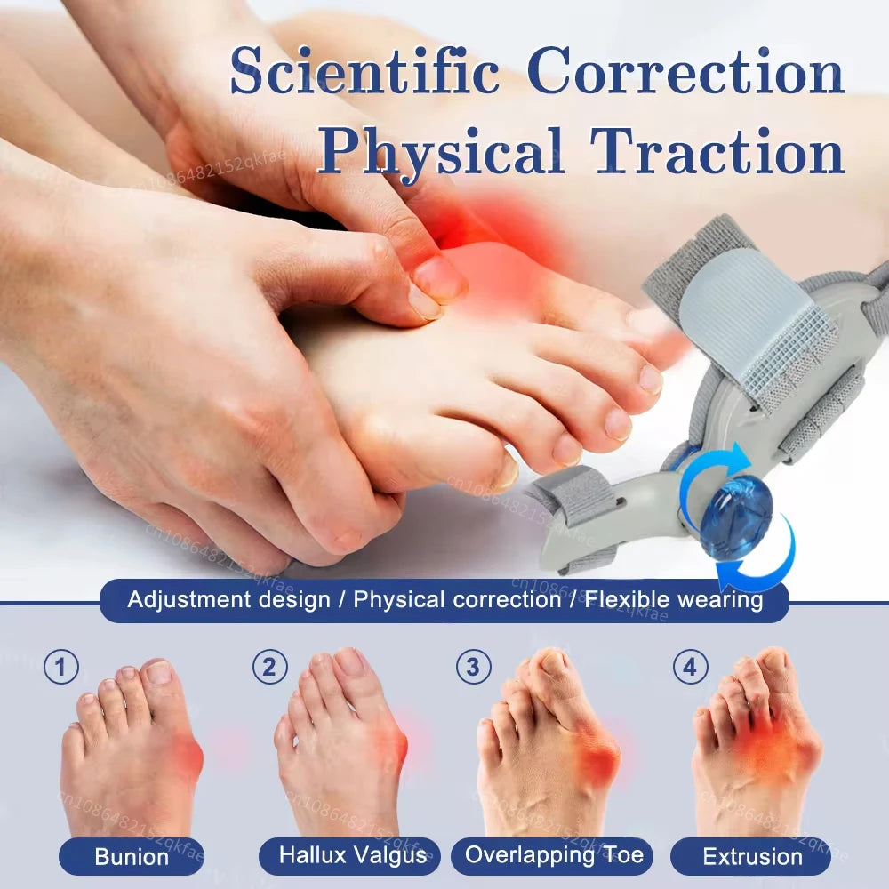 Adjustable Bunion Corrector – Hallux Valgus Toe Straightener & Orthopedic Foot Alignment Splint