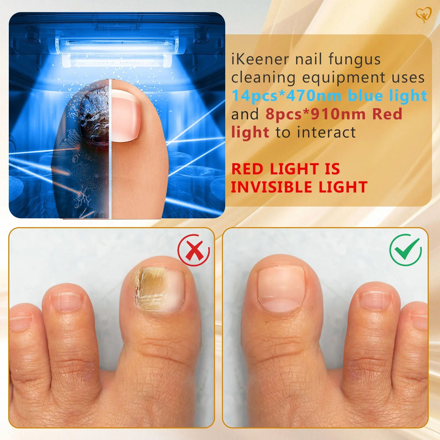 Wireless Nail Fungus Laser Device 45W – 14pcs 470nm Blue Light Therapy for Toenail Fungus, Onychomycosis & Paronychia Care