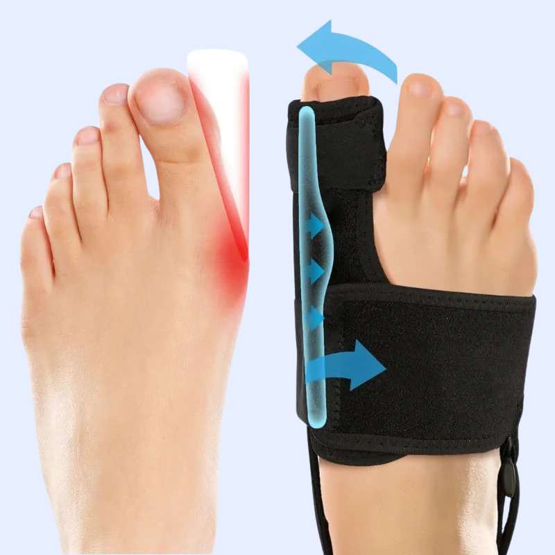 Toe Corrector Orthopedic Bunion Corrector