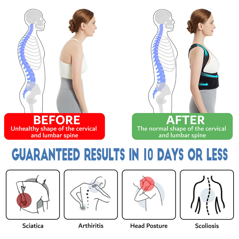 AlignFlex™ - Premium Posture Corrector Brace - Zorelie