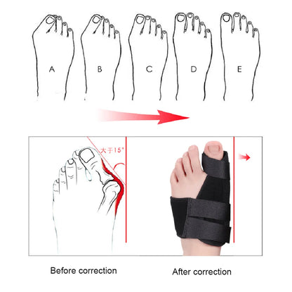 Soft Bunion Corrector