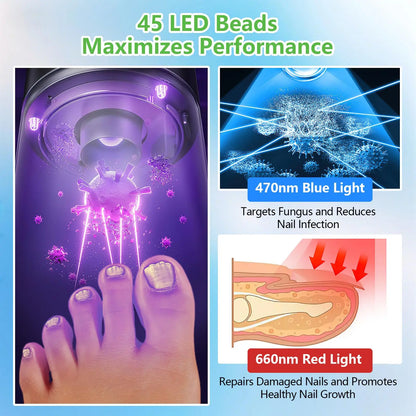 Laser Device for Nail Fungus Treatment – 15x Blue Light 470nm & 30x Red Light 650nm, Digital Display Nail Care Machine for Mycosis