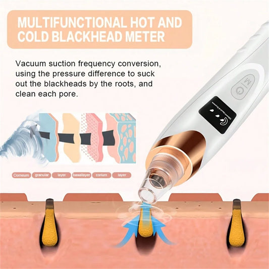 5 Suction Power Blackhead Remover Pore Vacuum – Electric Facial Pore Cleaner & Extractor Tool for Women & Adults