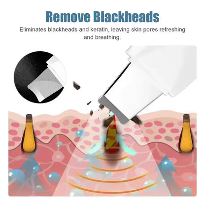 Ultrasonic Skin Scrubber – Deep Face Spatula Blackhead Remover & Facial Cleaner Massager