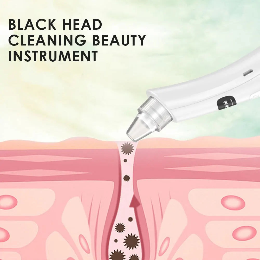 3-Mode Blackhead Remover Vacuum – Face Cleansing Beauty Device, Dead Skin & Pore Cleaner, Rechargeable Suction Machine