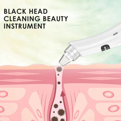 3-Mode Blackhead Remover Vacuum – Face Cleansing Beauty Device, Dead Skin & Pore Cleaner, Rechargeable Suction Machine
