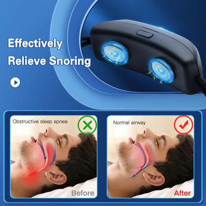 EMS Anti Snoring Device — Portable USB Rechargeable Stop Snore Aid for Comfortable Sleep & Sleep Apnea Relief