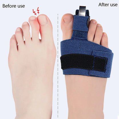 Toe Corrector & Bunion Straightener – Soft Orthotic Socks for Toe Alignment, Fracture Support & Foot Pain Relief