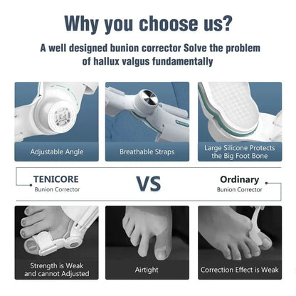 Bunion Corrector – Adjustable Hallux Valgus Orthotics Big Toe Straightener with 3-Angle Fixing Plate