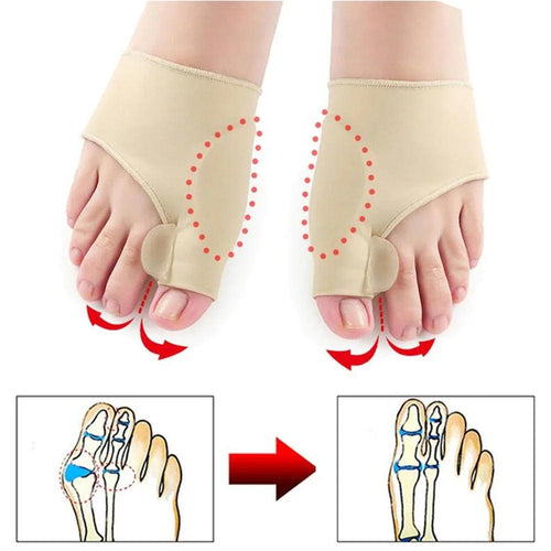 ToeAlign™ Gel Correctors – Orthopedic Toe Separators for Bunion Relief & Toe Alignment