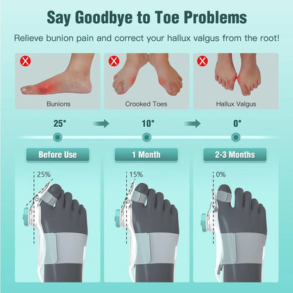 Adjustable Bunion Corrector – Hallux Valgus Toe Straightener & Orthopedic Foot Alignment Splint