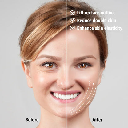 EMS Face Lifting Massager – Anti-Wrinkle, Firming Facial Massager for V-Face Lift, Double Chin Removal & Skin Care