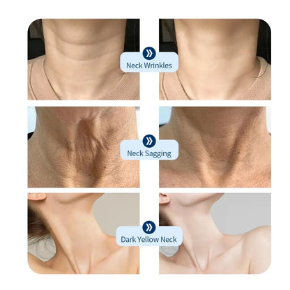 LED Neck Mask – Photon Therapy Skin Tightening Device, Anti-Wrinkle Neck Beauty Tool for Skin Brightening & Rejuvenation