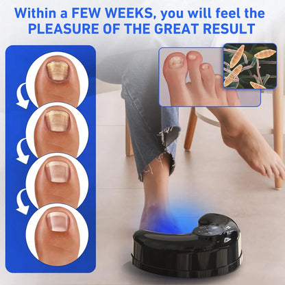 Wireless Nail Fungus Laser Treatment Device