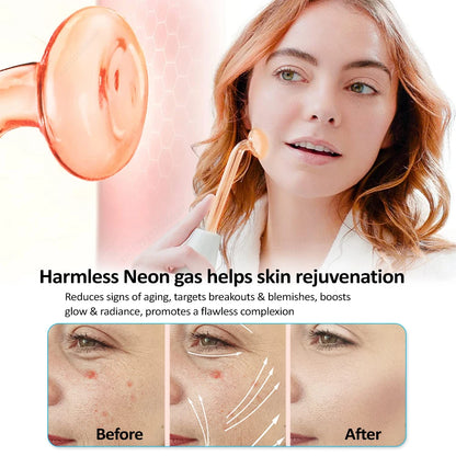 High Frequency Electrotherapy Wand with Neon Argon Glass Tube – Skin Tightening and Wrinkle Removal Device