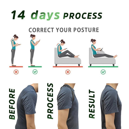 Adjustable Back Posture Corrector Belt – Spine Support Brace