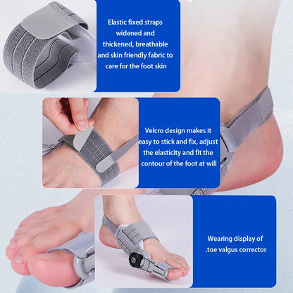 Adjustable Bunion Corrector Brace – Rotatable Toe Separator & Straightener for Hallux Valgus Relief