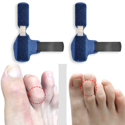 Toe Splint Straightener – Hammer Toe Corrector Brace for Crooked & Claw Toe Alignment, Adjustable Stabilizer Wrap for Pain Relief