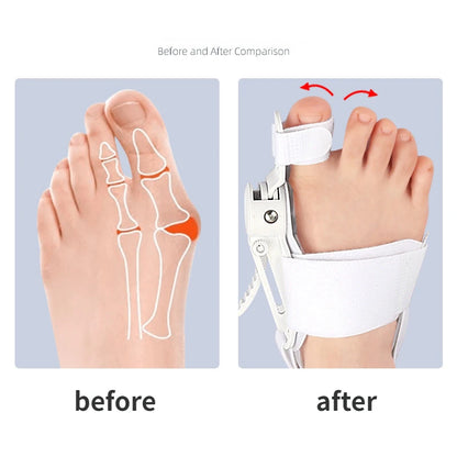 Hallux Valgus Bunion Corrector – Toe Separator & Foot Aligner for Bunions Relief and Toe Straightening