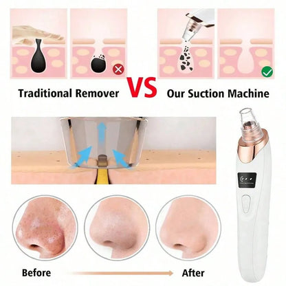 5 Suction Power Blackhead Remover Pore Vacuum – Electric Facial Pore Cleaner & Extractor Tool for Women & Adults