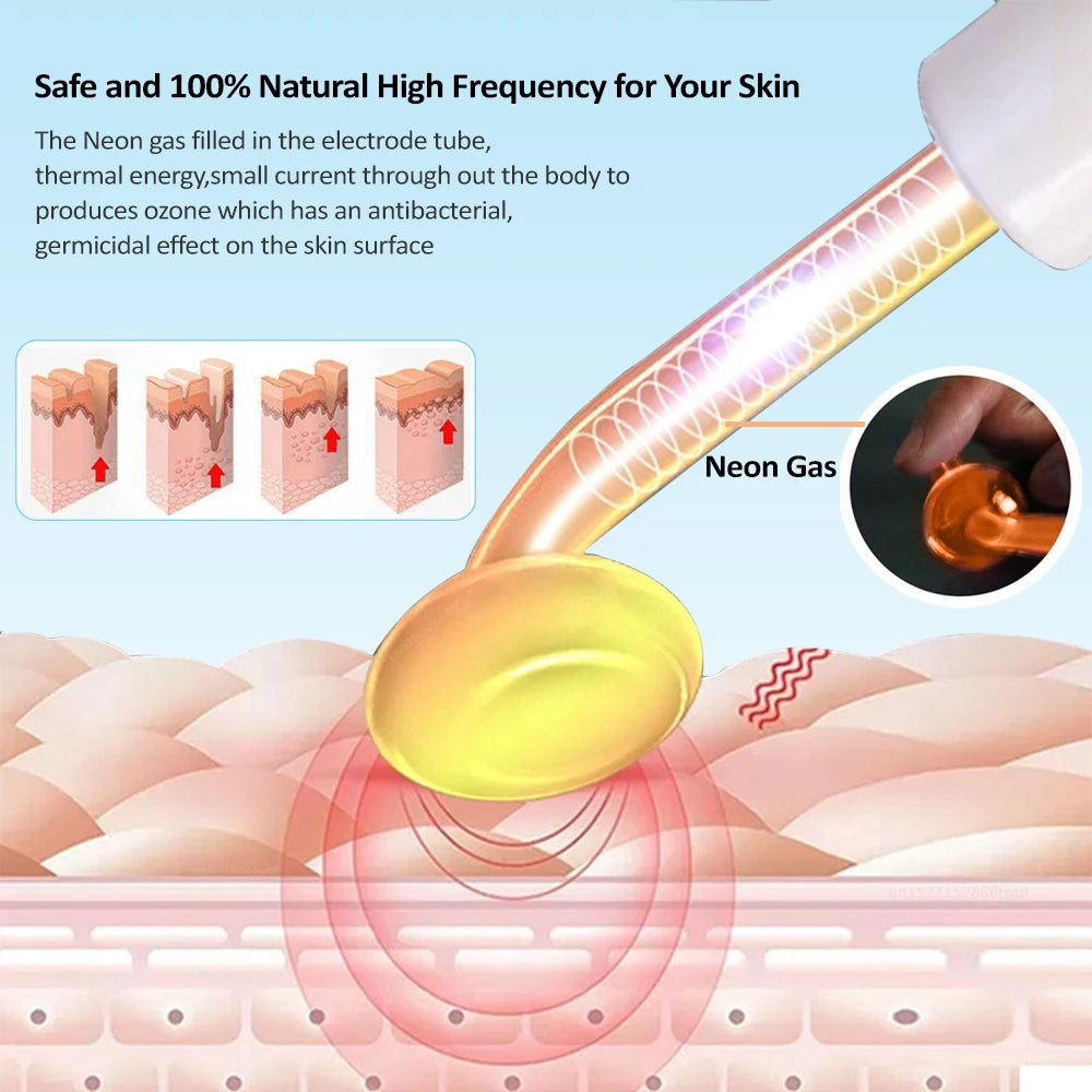 High Frequency Electrotherapy Wand with Neon Argon Glass Tube – Skin Tightening and Wrinkle Removal Device