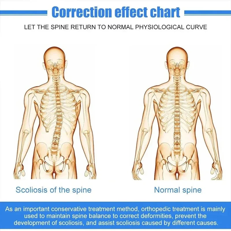 Correction effect chart showing scoliosis of the spine and normal spine for aluminium spinal brace for back pain