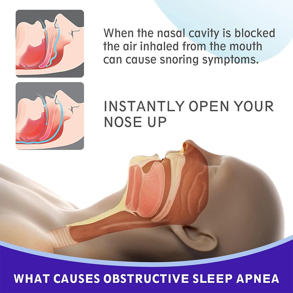 Diagram showing nasal cavity blockage causing snoring and how black nose strips for deep pore cleansing help open the nose