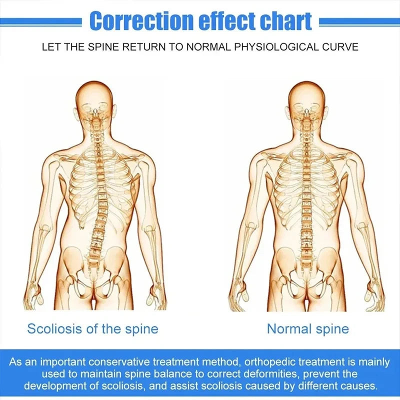 Correction effect chart showing scoliosis of the spine vs normal spine for fixed spinal brace for back support