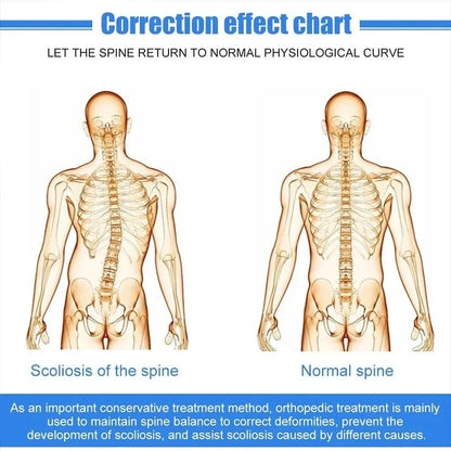Correction effect chart showing scoliosis of the spine vs normal spine for fixed spinal brace for back support