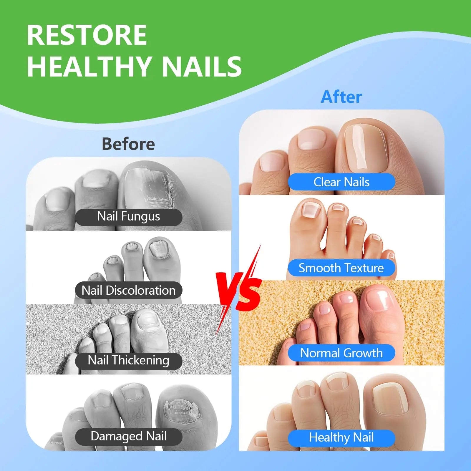 Before and after results of laser nail fungus treatment device showing clear nails, smooth texture, normal growth, and healthy nail