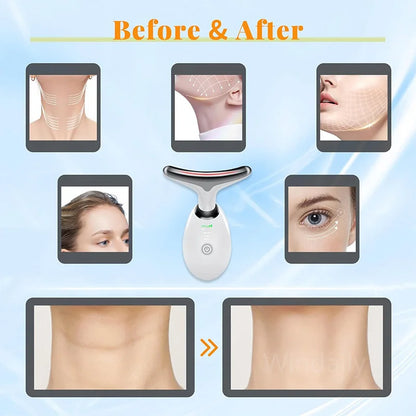 Zorelie.co LED neck and face massager showing before and after skin tightening results
