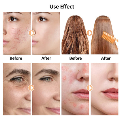 Before and after skin and hair improvements using high frequency facial wand for clearer skin and smoother hair