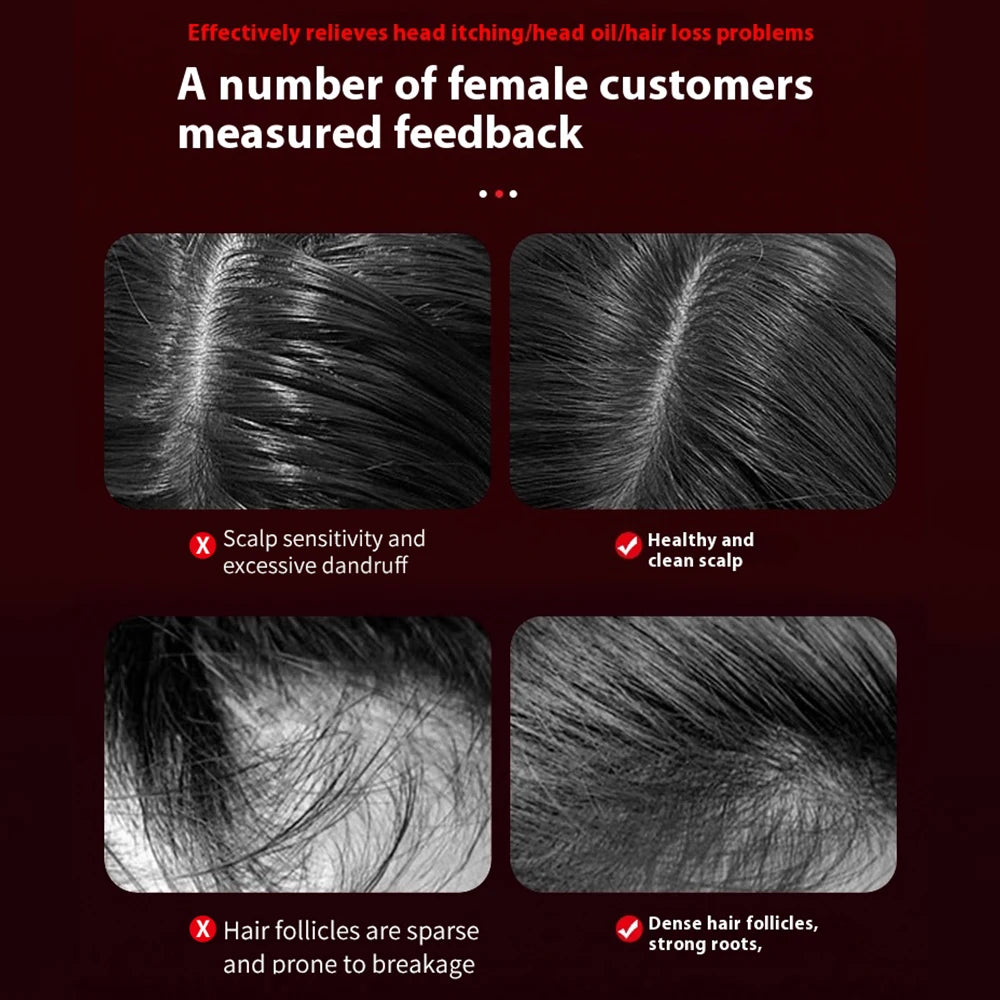 Before and after images showing scalp sensitivity and hair follicles improvement using scalp massager for hair growth