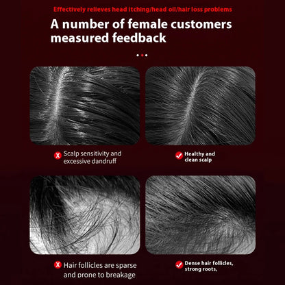 Before and after images showing scalp sensitivity and hair follicles improvement using scalp massager for hair growth