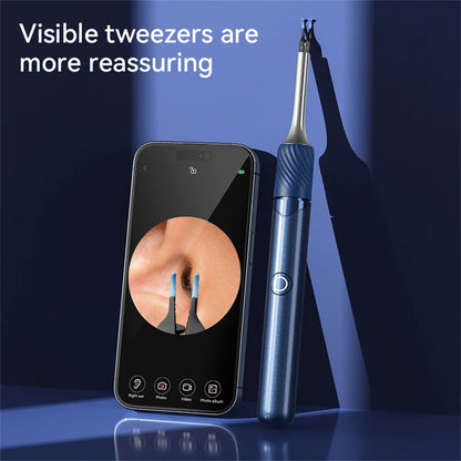 Zorelie.co visual ear cleaner with camera showing visible tweezers and real-time ear view on smartphone