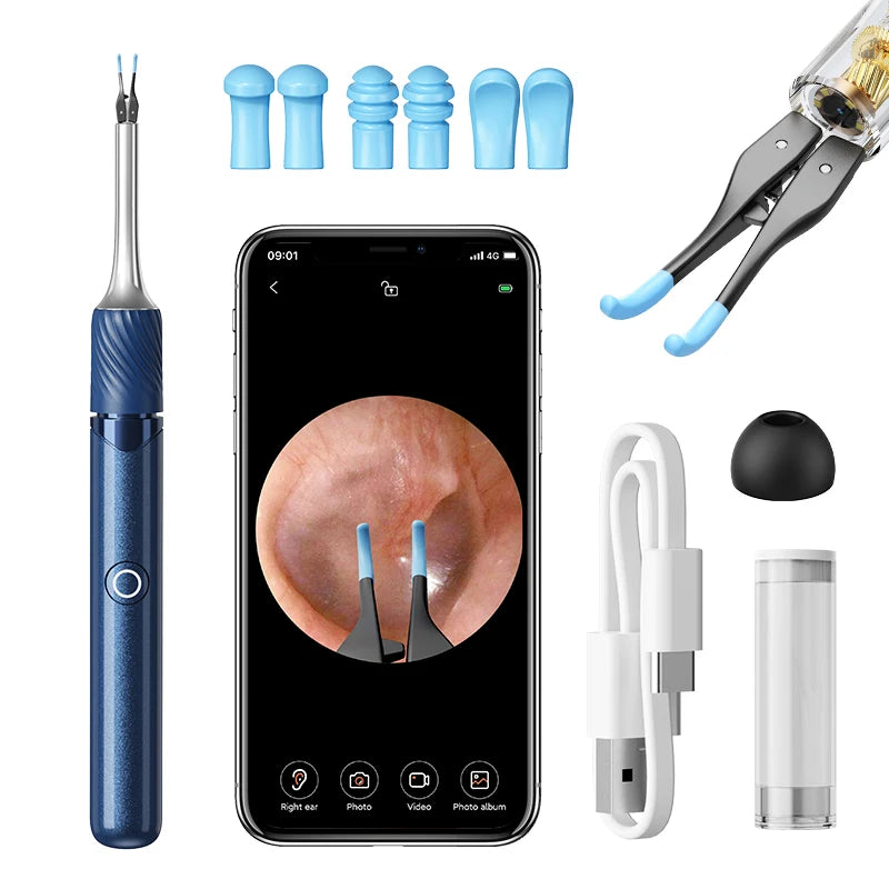 Visual ear cleaner with camera showing ear canal on smartphone screen with blue tips and USB charging cable